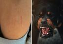 The 30-year-old woman was left with scratches after the second attack. Stock dog picture.