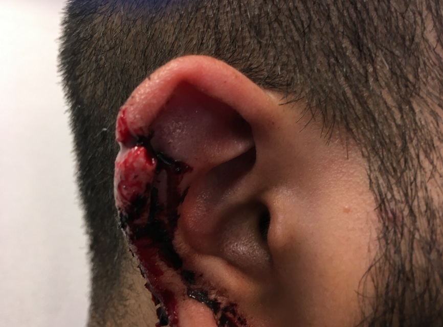 One victim was injured when a bolt went past his ear. Credit: Met Police